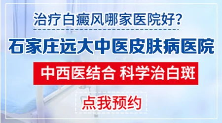 邯郸治疗皮肤白斑的医院 邯郸白癜风治疗医院