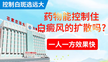 哪种药能控制住白癜风不扩散