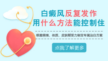 手上长白癜风控制住了后来又长出来怎么办