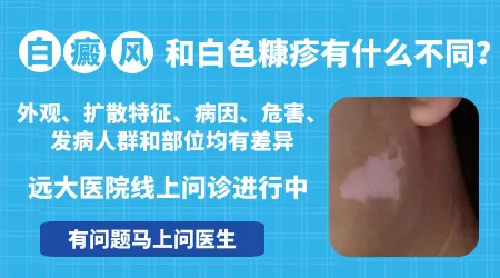 面部白斑图片白色糠疹和白癜风对照