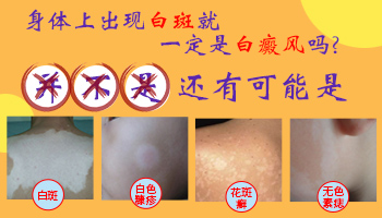孩子的脚面长个白斑如何看是不是白癜风