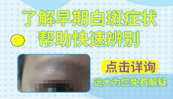 新生儿宝宝额头发白是怎么回事