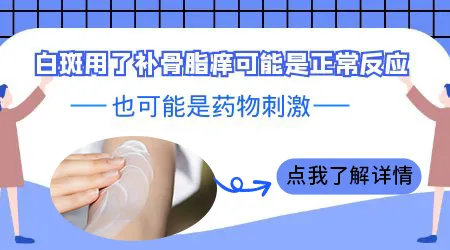 白癜风外用药涂完之后发痒要不要停药