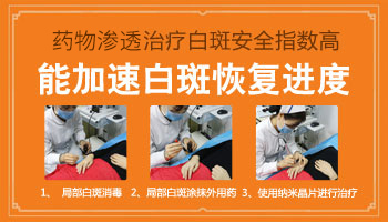 纳米促黑技术可以治疗白癜风吗