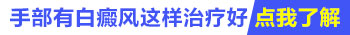 手上的白癜风为什么治不好