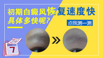 白癜风照308激光恢复过程有什么变化