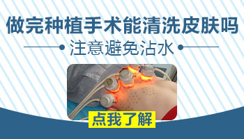 白癜风做了黑色素细胞移植手术后多久可以碰水