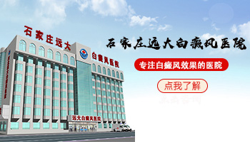 1岁多男孩身上有白斑怎么治