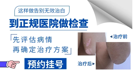 女童鼻子上长白斑是怎么回事