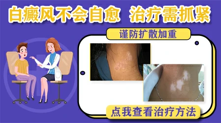 外伤引起的白斑能不能自愈