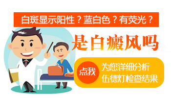 伍德灯下显示浅蓝白是白癜风吗