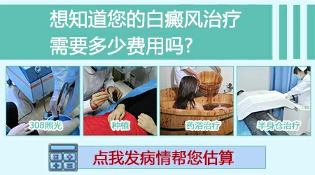 白癜风照311多久一次 照一次多长时间