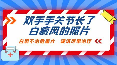 手关节处发白图片 皮肤白一块是白癜风吗