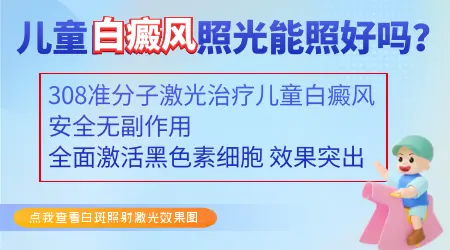 6岁孩子面部白癜风能不能照308准分子激光