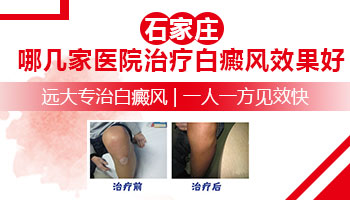 儿子背上有一块白斑扩散了怎么办