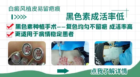 白癜风做植皮手术皮肤会留下疤痕吗