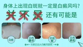 脚面上有块白斑是白癜风吗