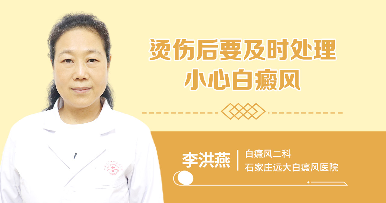 烫伤后要及时处理，小心白癜风