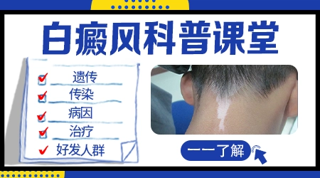 晕痣白斑遗传的几率有多少