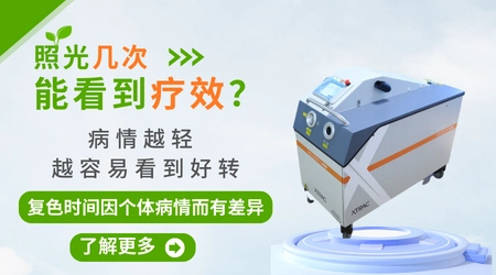 外伤引发的白癜风做光疗效果好不好
