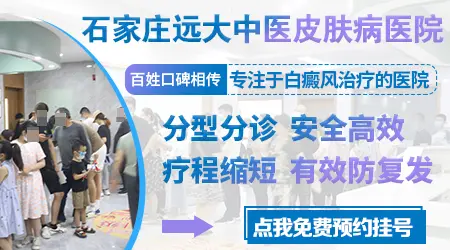 石家庄治疗皮肤白癜风的医院是哪个