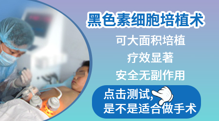 白癜风移植术后两月还有点白怎么回事