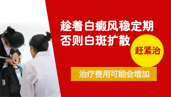 身上白斑不扩散还用治吗