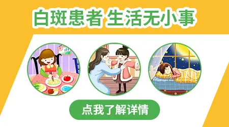 晕痣白癜风用药还是照激光好