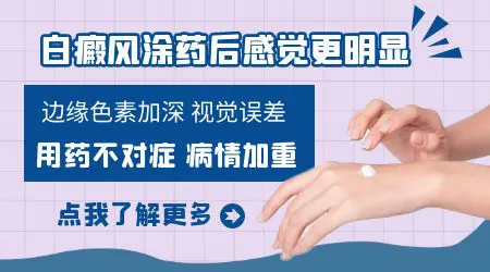 白癜风用药越用白斑越大正常吗