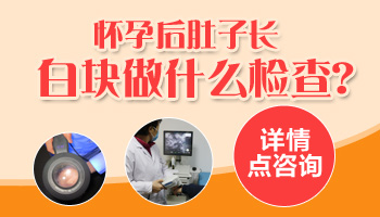 白癜风患者在照光期间怀孕了对孩子会有影响吗