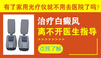 如何在家照光治疗白癜风