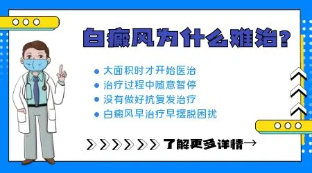 大街上卖的白癜风偏方有用吗