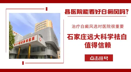 头皮白斑能做黑色素移植吗