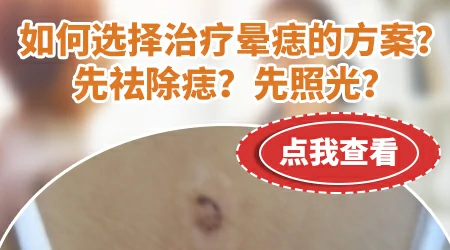 晕痣切除后白斑会自动消退吗