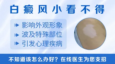 白癜风和普通白斑的外观对比图怎么看