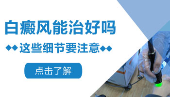 白癜风有硬币那么大能治愈吗
