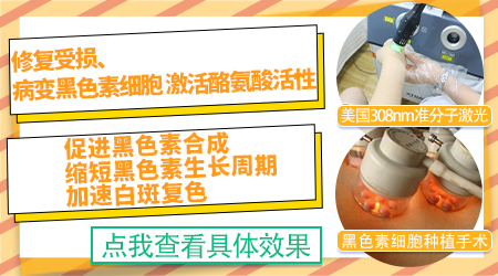 白癜风抹药膏能抹好吗