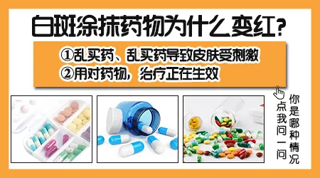 早期白癜风涂药后发红是正常的吗