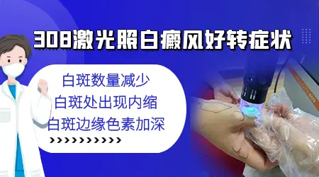 石家庄照308准分子激光价格 按什么收费