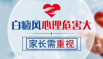 儿童头部白癜风怎么治疗