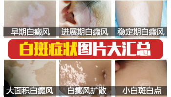 六个月宝宝身上长小白点图片