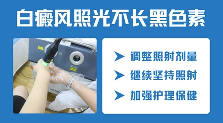 白癜风照308激光后没反应是剂量不够吗
