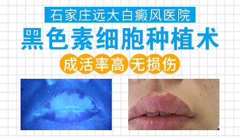 右眼睑和双耳后白癜风没有扩散怎么治