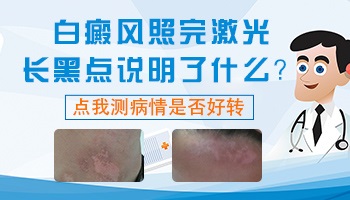 照光后白癜风处出现黑点图片