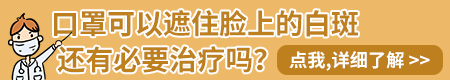面部白癜风黑色素移植安全吗 会复发吗