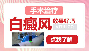 白癜风可以做手术吗