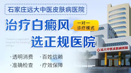 皮肤上出现白斑去石家庄哪个医院治好