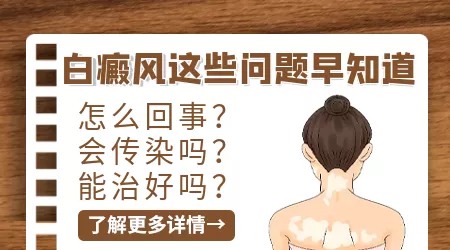 伍德灯检查疑似阳性那是不是白癜风