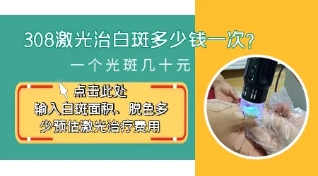 孩子手脚都有白癜风照一次308激光多少钱