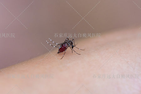 蚊子咬后皮肤为什么会有白点